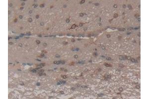 Detection of FAS in Rat Brain Tissue using Polyclonal Antibody to Factor Related Apoptosis (FAS) (FAS 抗体  (AA 21-170))