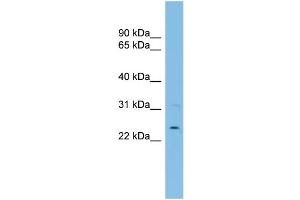 WB Suggested Anti-UBE2E3 Antibody Titration:  0.
