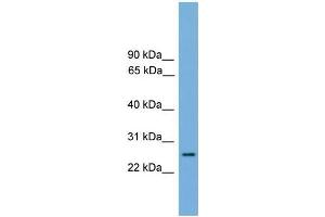 Human heart; WB Suggested Anti-RAB35 Antibody Titration: 0. (RAB35 抗体  (Middle Region))