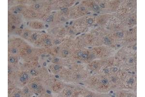 DAB staining on IHC-P; Samples: Human Liver Tissue (Neuroglobin 抗体  (AA 1-151))