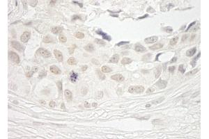 Immunohistochemistry (IHC) image for anti-Protein Phosphatase 1, Catalytic Subunit, beta Isoform (PPP1CB) (C-Term) antibody (ABIN7448736)