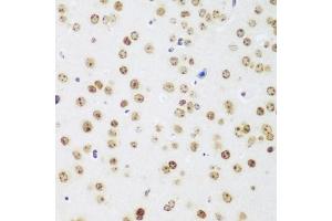 Immunohistochemistry of paraffin-embedded mouse brain using MECP2 antibody. (MECP2 抗体)