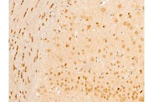 ABIN6267236 at 1/100 staining mouse brain tissue sections by IHC-P. (MAP3K7 抗体  (pThr187))