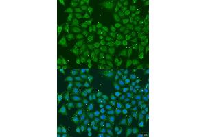 Immunofluorescence analysis of U2OS cells using AKR7A3 antibody. (AKR7A3 抗体  (AA 1-331))
