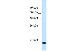 WB Suggested Anti-SSR2 Antibody Titration:  1. (SSR2 抗体  (N-Term))