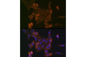 Immunofluorescence analysis of NIH/3T3 cells using LPP Rabbit mAb (ABIN7268284) at dilution of 1:100 (40x lens). (LPP 抗体)