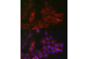 Immunofluorescence analysis of  cells using TROP-2 Rabbit pAb (ABIN7271104) at dilution of 1:100 (40x lens). (TACSTD2 抗体  (AA 27-270))