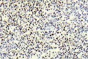 Immunohistochemistry (IHC) analyzes of p-Histone H3. (Histone H3.1 抗体  (pThr3))