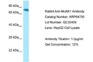 Western Blotting (WB) image for anti-NUAK Family, SNF1-Like Kinase, 1 (NUAK1) (N-Term) antibody (ABIN2789933) (NUAK1 抗体  (N-Term))