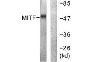 Western blot analysis of extracts from HepG2 cells, using MITF (Ab-180/73) Antibody. (MITF 抗体  (AA 151-200))