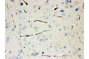 IHC testing of FFPE mouse lung with CGRP antibody. (CGRP 抗体)