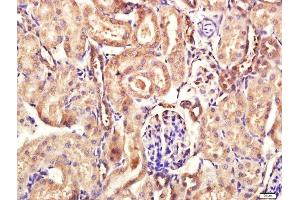 Paraformaldehyde-fixed, paraffin embedded rat kidney tissue, Antigen retrieval by boiling in sodium citrate buffer(pH6) for 15min, Block endogenous peroxidase by 3% hydrogen peroxide for 30 minutes, Blocking buffer (normal goat serum) at 37°C for 20min, Antibody incubation with Rabbit Anti-Calpain 1 Polyclonal Antibody, Unconjugated  at 1:400 overnight at 4°C, followed by a conjugated secondary and DAB staining (CAPN1 抗体  (AA 625-713))