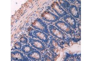 Immunohistochemistry (IHC) image for anti-Calpain 1, Large Subunit (CAPNL1) antibody (ABIN7438319)