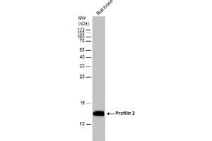 Western Blotting (WB) image for anti-Profilin 2 (PFN2) antibody (ABIN2856620)