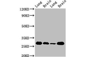 Western Blot Positive WB detected in: Rat lung tissue, Rat brain tissue, Mouse lung tissue, Mouse brain tissue All lanes: SFN antibody at 5 μg/mL Secondary Goat polyclonal to rabbit IgG at 1/50000 dilution Predicted band size: 28, 25 kDa Observed band size: 28 kDa (14-3-3 sigma/SFN 抗体  (AA 1-248))