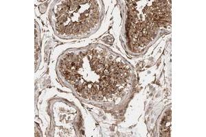 Immunohistochemical staining of human testis with LOC388333 polyclonal antibody  shows moderate cytoplasmic positivity in cells in seminiferus duct cells at 1:10-1:20 dilution. (SPDYE4 抗体)