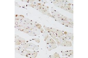 Immunohistochemistry of paraffin-embedded mouse heart using KDM4A antibody (ABIN5975678) at dilution of 1/100 (40x lens). (KDM4A 抗体)