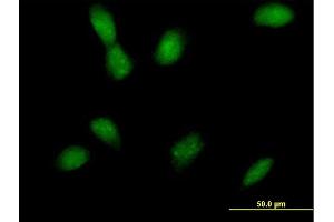 Immunofluorescence of purified MaxPab antibody to MAP2K4 on HeLa cell. (MAP2K4 抗体  (AA 1-399))