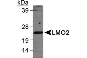 Western blot analysis of LMO2 in Ramos whole cell lysate using LMO2 polyclonal antibody . (LMO2 抗体  (AA 1-100))