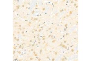 Immunohistochemistry of paraffin embedded rat brain using Arhgap17 (ABIN7075416) at dilution of 1: 700 (400x lens) (ARHGAP17 抗体)
