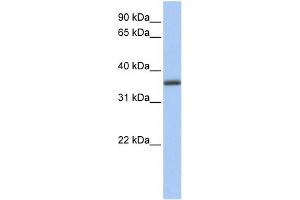 WB Suggested Anti-GALE Antibody Titration: 0. (GALE 抗体  (N-Term))