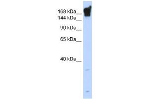 DYSF antibody used at 1 ug/ml to detect target protein. (Dysferlin 抗体)