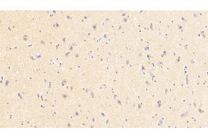 Detection of NMU in Human Cerebrum Tissue using Polyclonal Antibody to Neuromedin U (NMU) (Neuromedin U 抗体  (AA 35-158))