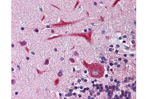 Immunohistochemistry (IHC) image for anti-Potassium Voltage-Gated Channel, Subfamily H (Eag-Related), Member 2 (KCNH2) (Internal Region) antibody (ABIN1048984)