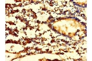Immunohistochemistry of paraffin-embedded human appendix tissue using ABIN7152778 at dilution of 1:100 (FGF13 抗体  (AA 1-245))