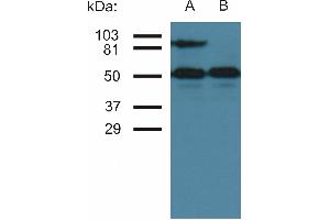 Western blottin analysis of CD54 expression in TNF-alpha activated (A) and nonactivated (B) HUVEC cells by antibody MEM-111. (ICAM1 抗体  (PE))