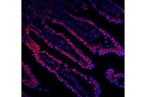 IF analysis of DDX5 using anti-DDX5 antibody (ABIN7602561). (DDX5 抗体  (AA 85-328))