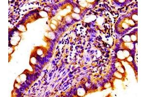 Immunohistochemistry of paraffin-embedded human small intestine tissue using ABIN7161709 at dilution of 1:100 (Norrie Disease (Pseudoglioma) 抗体  (AA 25-133))