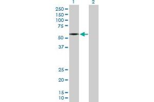 Western Blot analysis of SLC1A2 expression in transfected 293T cell line by SLC1A2 MaxPab polyclonal antibody. (SLC1A2 抗体  (AA 1-574))