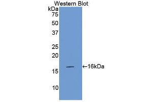 Western blot analysis of the recombinant protein. (Factor VII 抗体  (AA 315-433))