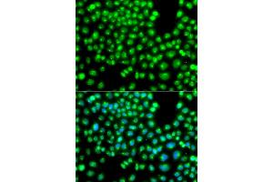Immunofluorescence analysis of A549 cells using GOPC antibody (ABIN4903801).