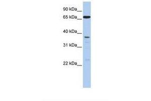 anti-ATP-Binding Cassette, Sub-Family B (MDR/TAP), Member 9 (ABCB9) (N-Term) antibody