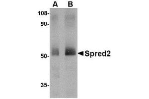 Image no. 1 for anti-Sprouty-Related, EVH1 Domain Containing 2 (SPRED2) (Internal Region) antibody (ABIN341679) (SPRED2 抗体  (Internal Region))