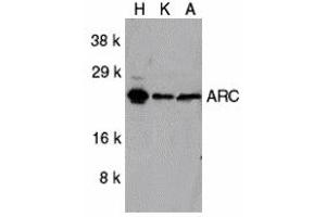 Western Blotting (WB) image for anti-ARC (C-Term) antibody (ABIN1030252) (ARC (C-Term) 抗体)