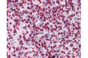Anti-HIPK1 antibody IHC of human spleen. (HIPK1 抗体  (AA 330-430))