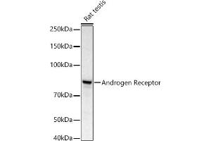 Western blot analysis of extracts of Rat testis, using Androgen Receptor antibody (ABIN3022797, ABIN3022798, ABIN3022799 and ABIN6219233) at 1:668 dilution. (Androgen Receptor 抗体)