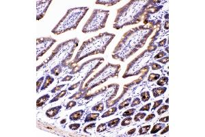IHC analysis of AMFR using anti-AMFR antibody (ABIN4886455).