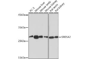 Western blot analysis of extracts of various cell lines, using SRD5 Rabbit mAb (ABIN7270595) at 1:1000 dilution. (SRD5A2 抗体)