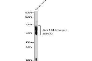 Western blot analysis of extracts of Human plasma, using Alpha-1 Antichymotrypsin (SERPIN) antibody (ABIN3016733, ABIN3016734, ABIN3016735 and ABIN6219829) at 1:1000 dilution. (SERPINA3 抗体  (AA 24-423))