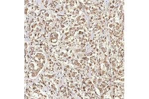 IHC analysis of RBMS1 using anti-RBMS1 antibody (ABIN7601195).