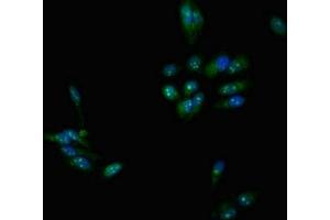 Immunofluorescent analysis of Hela cells using ABIN7159195 at dilution of 1:100 and Alexa Fluor 488-congugated AffiniPure Goat Anti-Rabbit IgG(H+L) (DMC1 抗体  (AA 5-153))