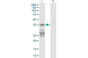 Western Blot analysis of CNN3 expression in transfected 293T cell line by CNN3 monoclonal antibody (M03), clone 2C7. (CNN3 抗体  (AA 1-329))