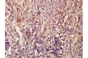 Immunohistochemistry (IHC) image for anti-Tubulin, beta 3 (TUBB3) (AA 31-130) antibody (ABIN672231)