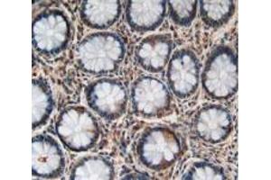 Figure. (LPCAT3 抗体  (AA 122-233))