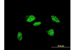 Immunofluorescence of monoclonal antibody to UBR2 on HeLa cell. (UBR2 抗体  (AA 1-100))