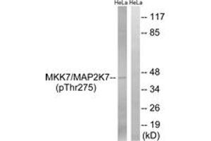 Western blot analysis of extracts from HeLa cells treated with calyculinA 50ng/ml 30', using MAP2K7 (Phospho-Thr275) Antibody. (MAP2K7 抗体  (pThr275))